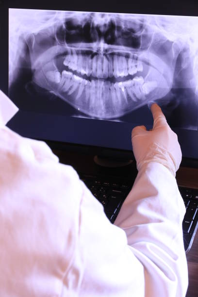 Best Emergency Treatment for Dental Infections or Abscesses in Tropical Park, FL